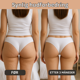 LIV| Innovativ 3D Anti-Cellulitt Leggings