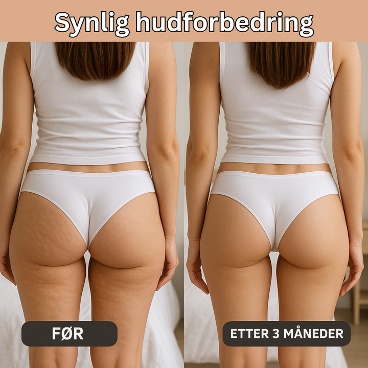 LIV| Innovativ 3D Anti-Cellulitt Leggings